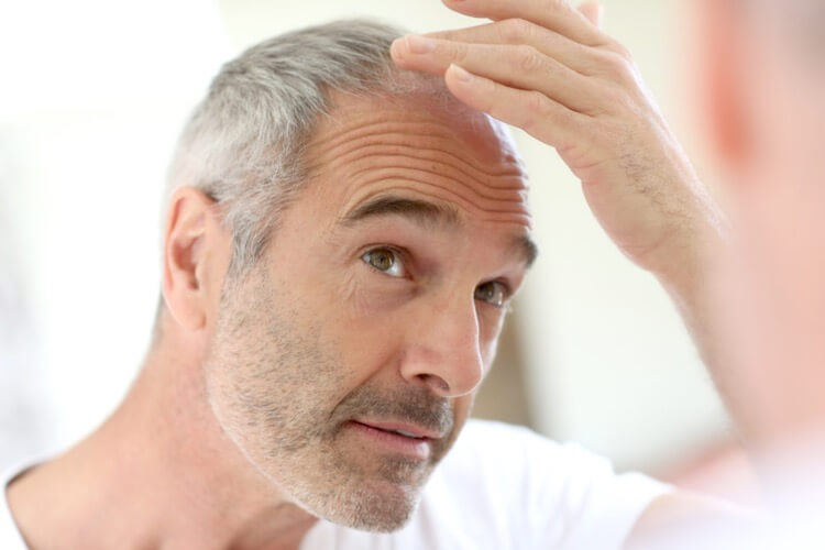 Older man looking at his thinning hair in the mirror. Happy Head dermatologists can help you get your hair back with a custom topical treatment made with the strongest hair growth medicine available online. 