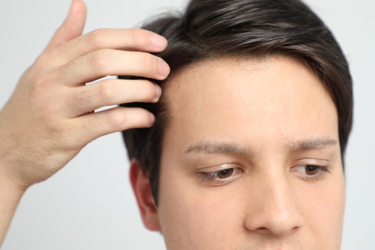 When Will Your Hair Grow Back? Your Topical Hair Loss Treatment Timeline. |  Happy Head