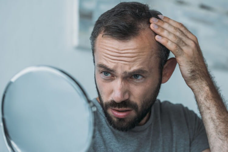 Losing your hair can have serious effects on your mental health. This customer is looking at his hair in the mirror and noticing that his hair isn't as thick as it used to be, but now he's using Happy Head custom hair loss treatments to stop hair loss and gain confidence. 