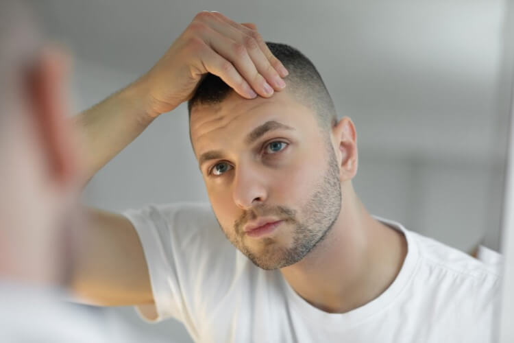 Does Testosterone Cause Hair Loss  Asmed Hair Transplant