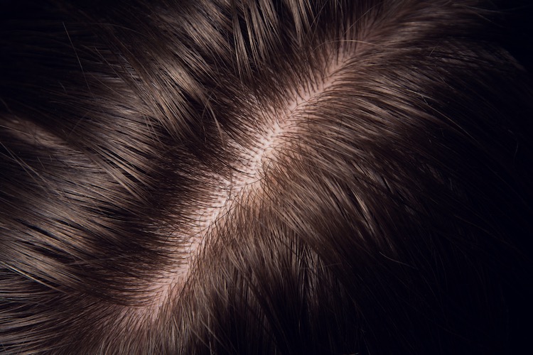  A healthy scalp means healthy hair growth. To get your scalp back on track for great hair growth results, there are a few things our happy head dermatologists recommend. 