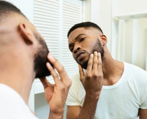 Here are the reasons you shouldn't ignore beard hair loss. Our dermatologists at Happy Head give you tips and tricks to grow it back.