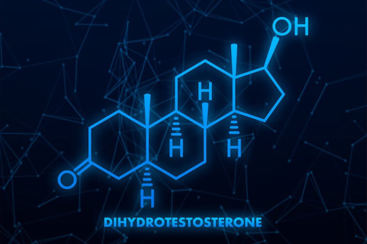 Dihydrotestosterone is one of the primary causes of hair loss. The Happy Head dermatologists break down the hormone and why it causes hair loss, in addition to how to treat it. 